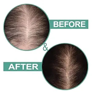 UOYOU Hair Building Fibers 27.5g – 30 Second Mein Ghane Baal | Natural Keratin Hair Thickening Powder (Black)